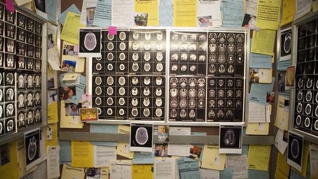 GREY'S ANATOMY - "Elevator Love Letter" - X-Rays seen in Derek's elevator love letter, on "Grey's Anatomy," THURSDAY, MARCH 26 (9:00-10:02 p.m., ET) on the ABC Television Network. (ABC/RANDY HOLMES) X-RAYS