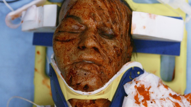 GREY'S ANATOMY - "Now or Never" - Patient "John Doe" after being run-over by a bus while saving a young woman, on "Grey's Anatomy," THURSDAY, MAY 14 (9:00-11:00 p.m., ET) on the ABC Television Network. T.R. KNIGHT