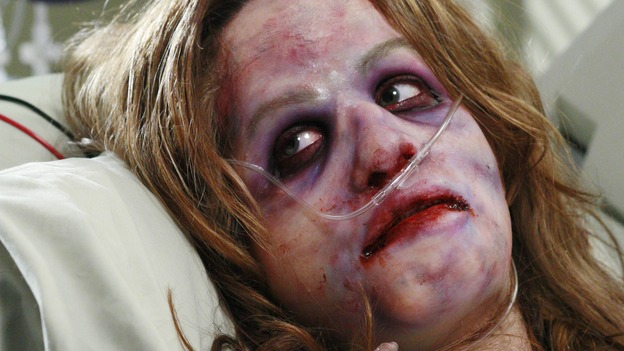 GREY'S ANATOMY - "Some Kind of Miracle" - One person's fight to live affects everyone at Seattle Grace, in the dramatic conclusion to "Grey's Anatomy's" three-episode story arc. "Some Kind of Miracle" airs THURSDAY, FEBRUARY 22 (9:00-10:01 p.m., ET) on the ABC Television Network. Elizabeth Reaser (Independent Spirit Award nominee for "Sweet Land") guest stars as a patient. (ABC/RON TOM)ELIZABETH REASER