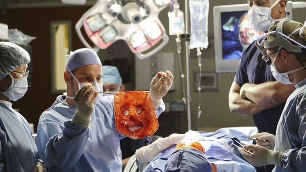 GREY'S ANATOMY - "Stand By Me" - Alex assists in removing a donor face for Mark Sloan's face transplant procedure, on "Grey's Anatomy," THURSDAY, MARCH 19 (9:00-10:02 p.m., ET) on the ABC Television Network. (ABC/CRAIG SJODIN) JUSTIN CHAMBERS, JAMES PICKENS JR., KEVIN MCKIDD