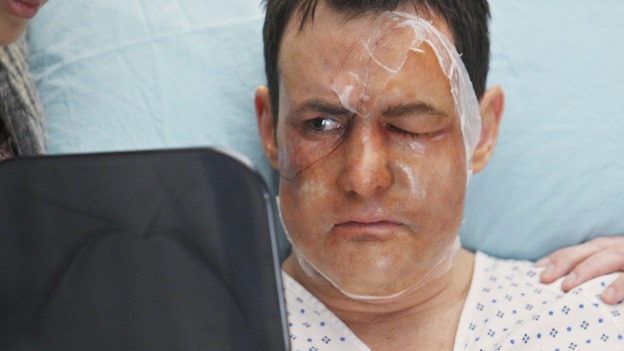 GREY'S ANATOMY - "Stand By Me" - Dave aka "Blowhole" after his successful face transplant surgery, on "Grey's Anatomy," THURSDAY, MARCH 19 (9:00-10:02 p.m., ET) on the ABC Television Network. (ABC/CRAIG SJODIN) LARRY SULLIVAN