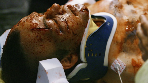 GREY'S ANATOMY - "Now or Never" - Patient "John&nbsp;Doe" after being run-over by a bus while saving a young woman, on "Grey's Anatomy," THURSDAY, MAY 14 (9:00-11:00 p.m., ET) on the ABC Television Network. T.R. KNIGHT